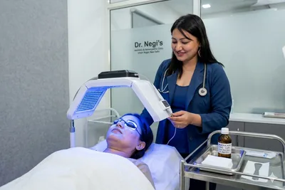 Acne Scar Treatment Delhi | Laser & RF | Dr Negi Clinic treatment