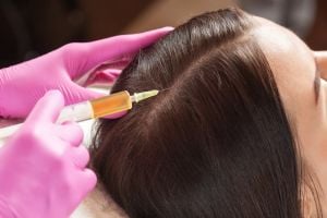 PRP Hair Treatment Package